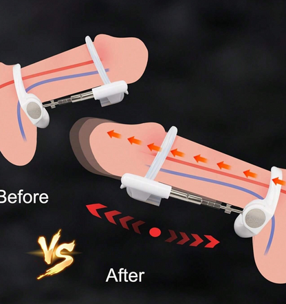 EXTENSOR DE PENE AJUSTABLE – DISPOSITIVO DE AGRANDAMIENTO MASCULINO | AUMENTO DE LONGITUD NATURAL Y PROGRESIVO